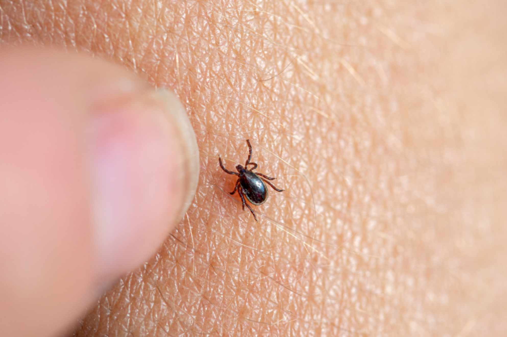 tick borne encephalitis vaccine